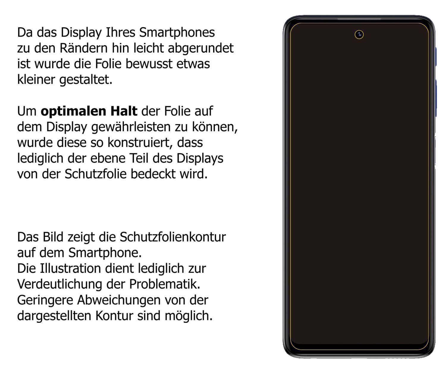 Blickschutzfolie für Motorola Moto G51 5G matt Sch (5)