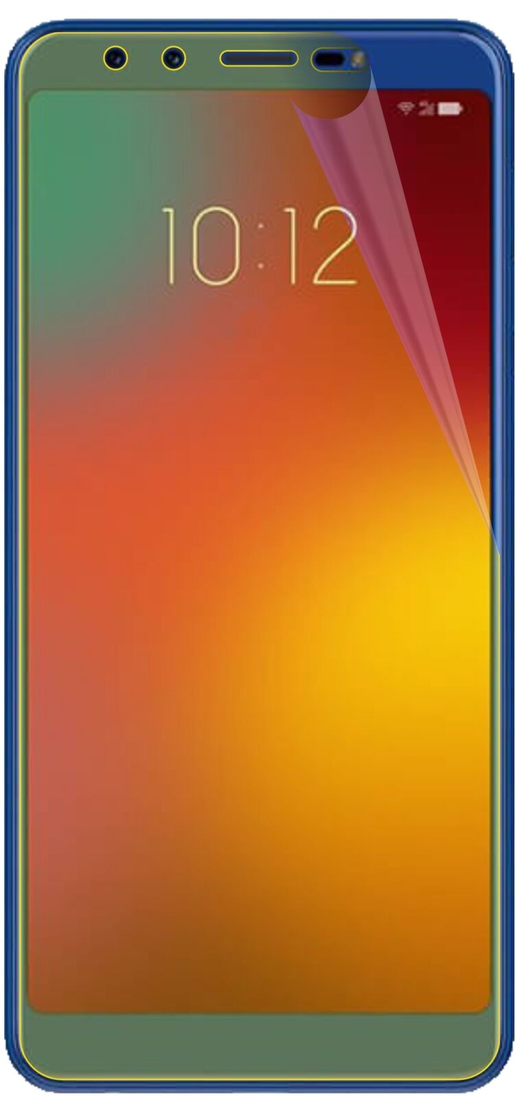 dipos Displayschutz für Lenovo K9, transparente Oberfläche, geringe Dicke und perfekte Passform