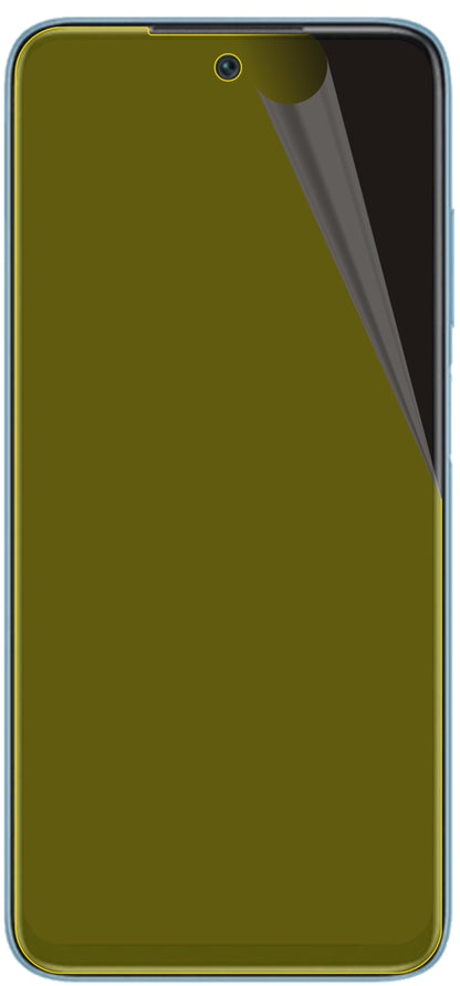 dipos Displayschutz für Xiaomi Redmi 10, transparente Oberfläche, geringe Dicke und perfekte Passform